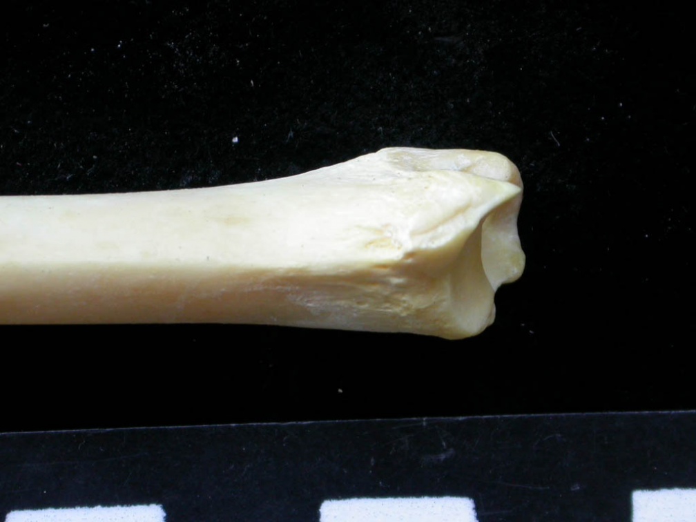 Tibia : partie distale