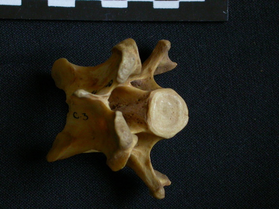 Cervical vertebrae