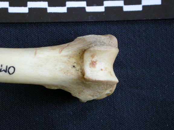 Fémur : parte distal