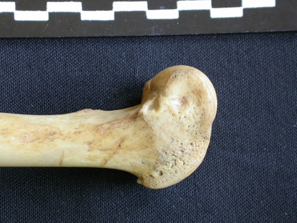 Femur: distal part