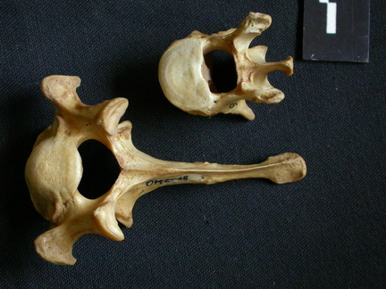 Lumbar vertebrae