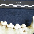 Dentition inférieure