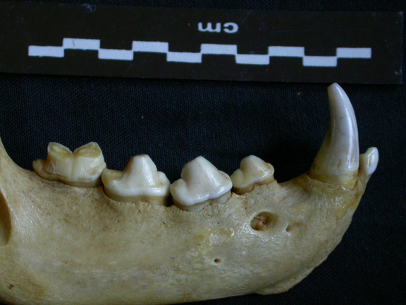 Dentition inférieure