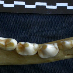 Dentición inferior