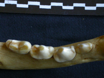 Dentition inférieure