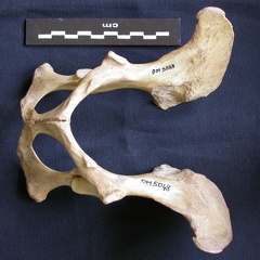 Pelvis