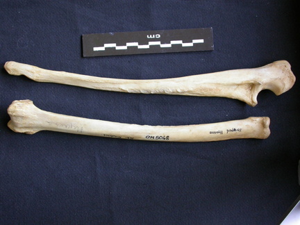 Radius et ulna