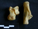Talus and calcaneus