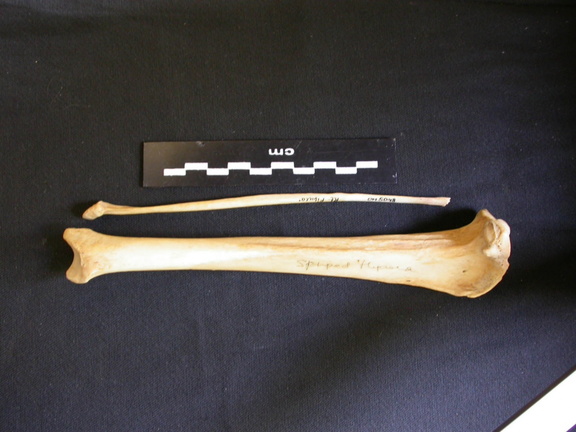 Tibia et fibula