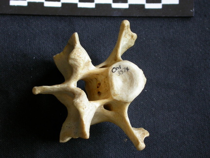 Cervical vertebra