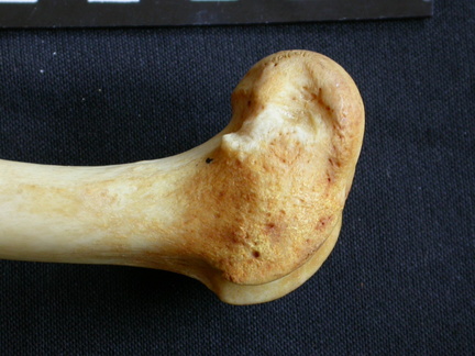 Femur: distal part