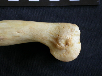 Humerus: distal part