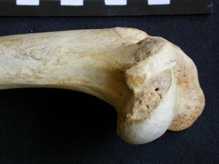 Humerus: proximale part