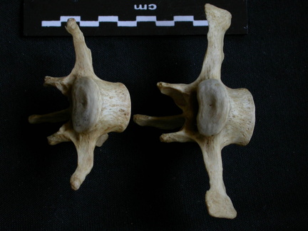 Lumbar vertebrae