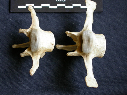 Lumbar vertebrae