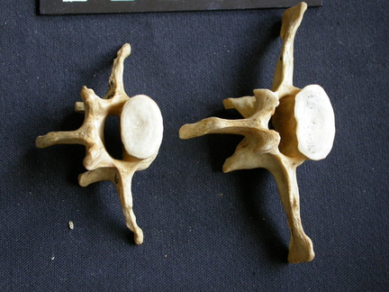 Lumbar vertebrae