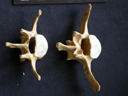 Lumbar vertebrae