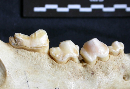 Lower teeth