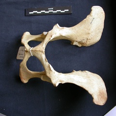 Pelvis