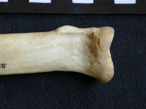 Radius: proximale part