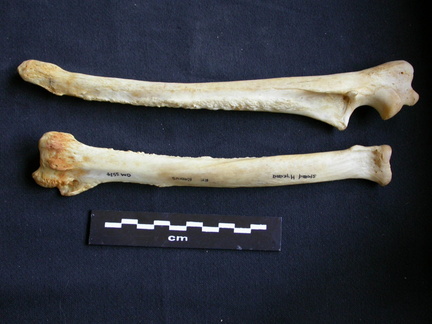 Radius and ulna