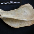 Scapula : vue latérale