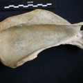 Scapula : vue latérale