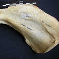 Scapula : vue médiale