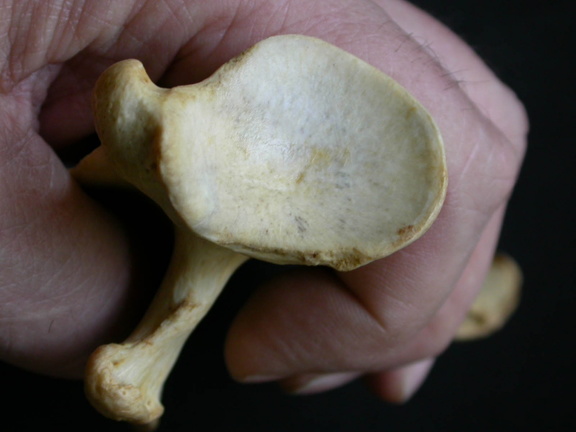 Scapula : vue ventrale