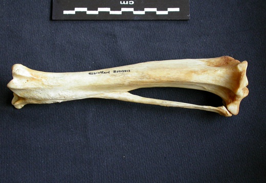 Tibia and fibula