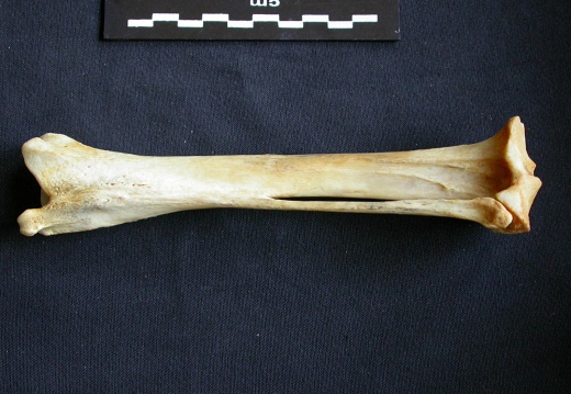 Tibia et fibula