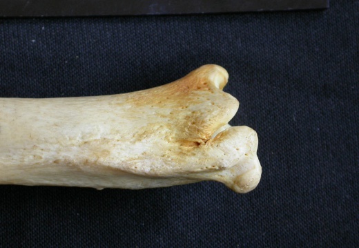 Tibia and fibula: distal part