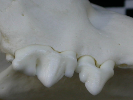 Dentition supérieure