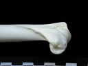 Humerus: distal part