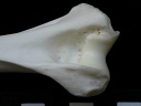 Humerus: distal part