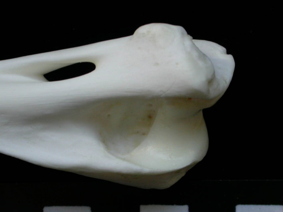 Humerus: distal part