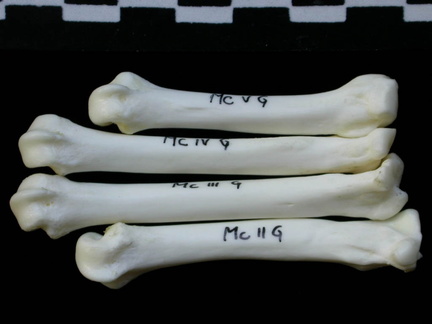 Metacarpals