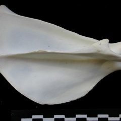 Scapula : vue latérale