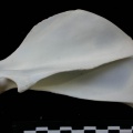 Scapula : vue latérale