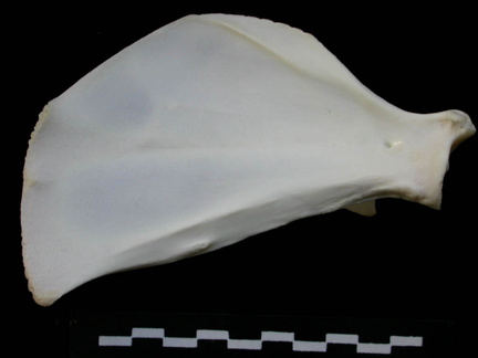 Scapula : vue médiale