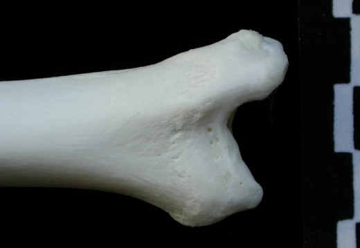 Tibia : parte distal