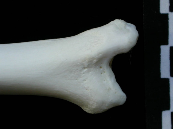 Tibia : partie distale