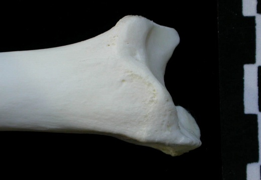  Tibia: distal part