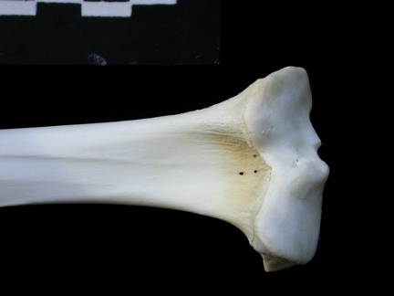  Tibia: proximale part