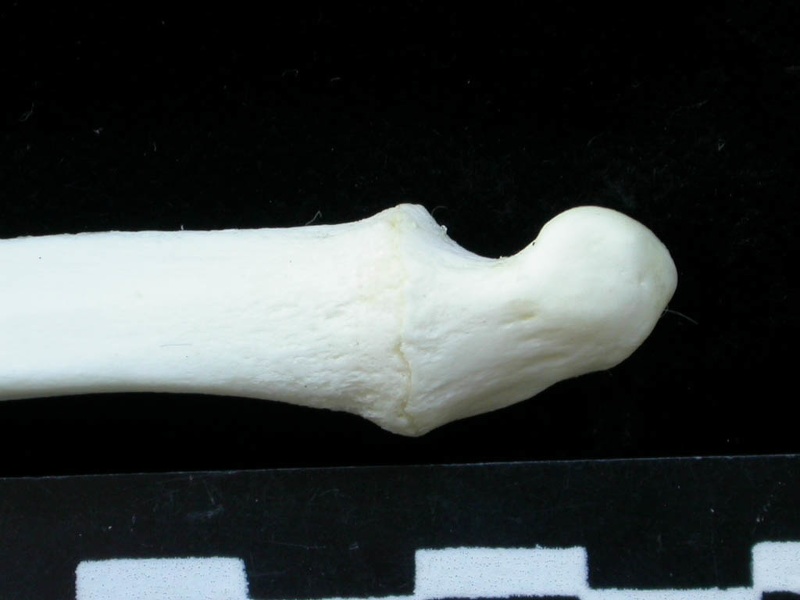  Ulna: distal part