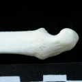 Ulna : partie distale