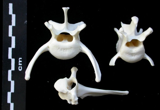 Vertebrae