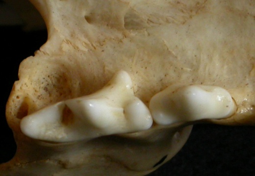 Dentition supérieure