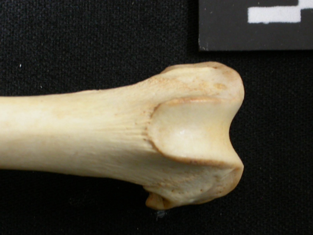 Fémur : partie distale