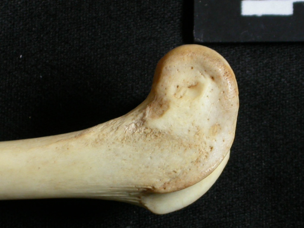 Fémur : partie distale